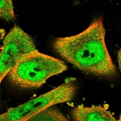 ZNF282 Antibody, Novus Biologicals:Antibodies:Primary Antibodies